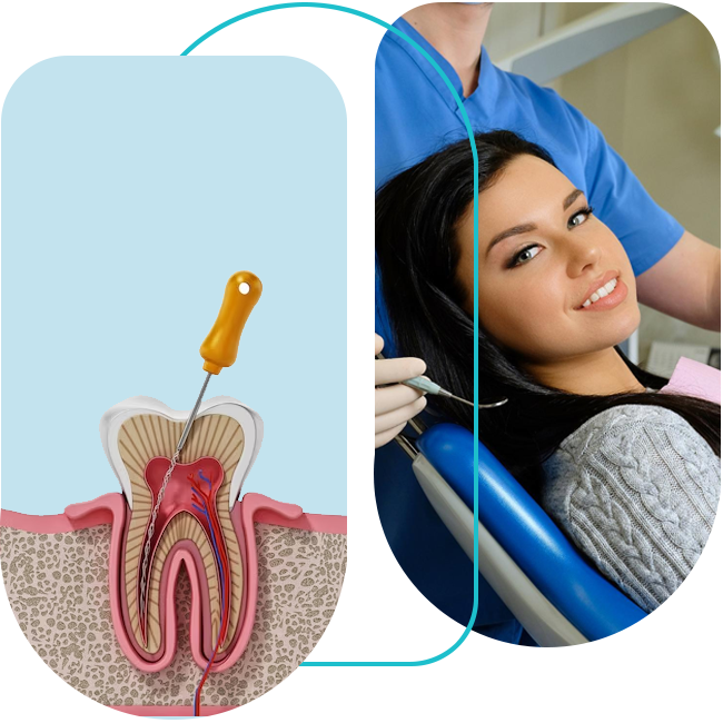 Dentist performing root canal treatment in Bittern