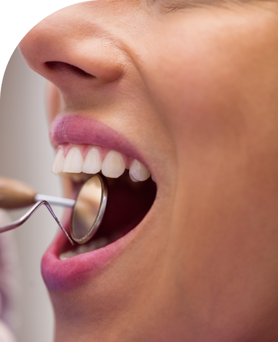 Dentist performing cavity filling with composite material